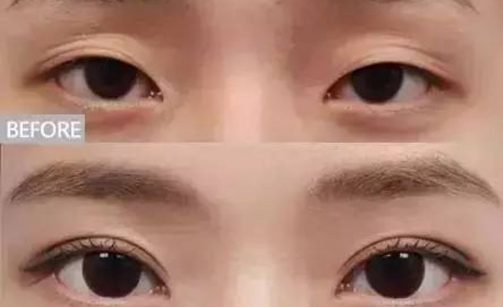 化妆师必学专业技巧：遇到肿泡眼新娘千万注意